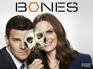 Bones